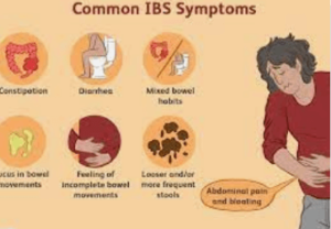 IBS causes