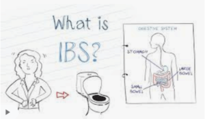 What is IBS